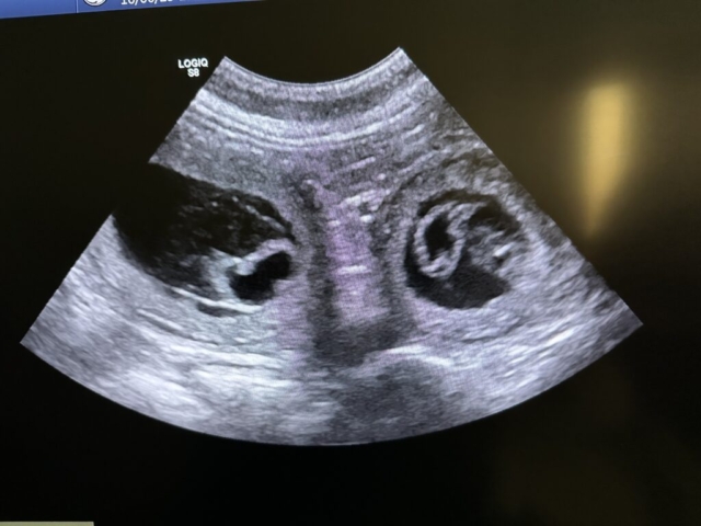 30 day scan