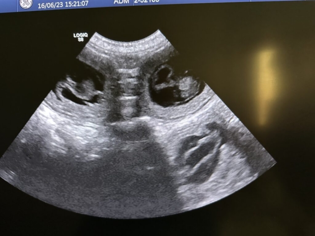 30 day scan
