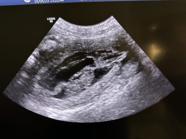 30 day scan